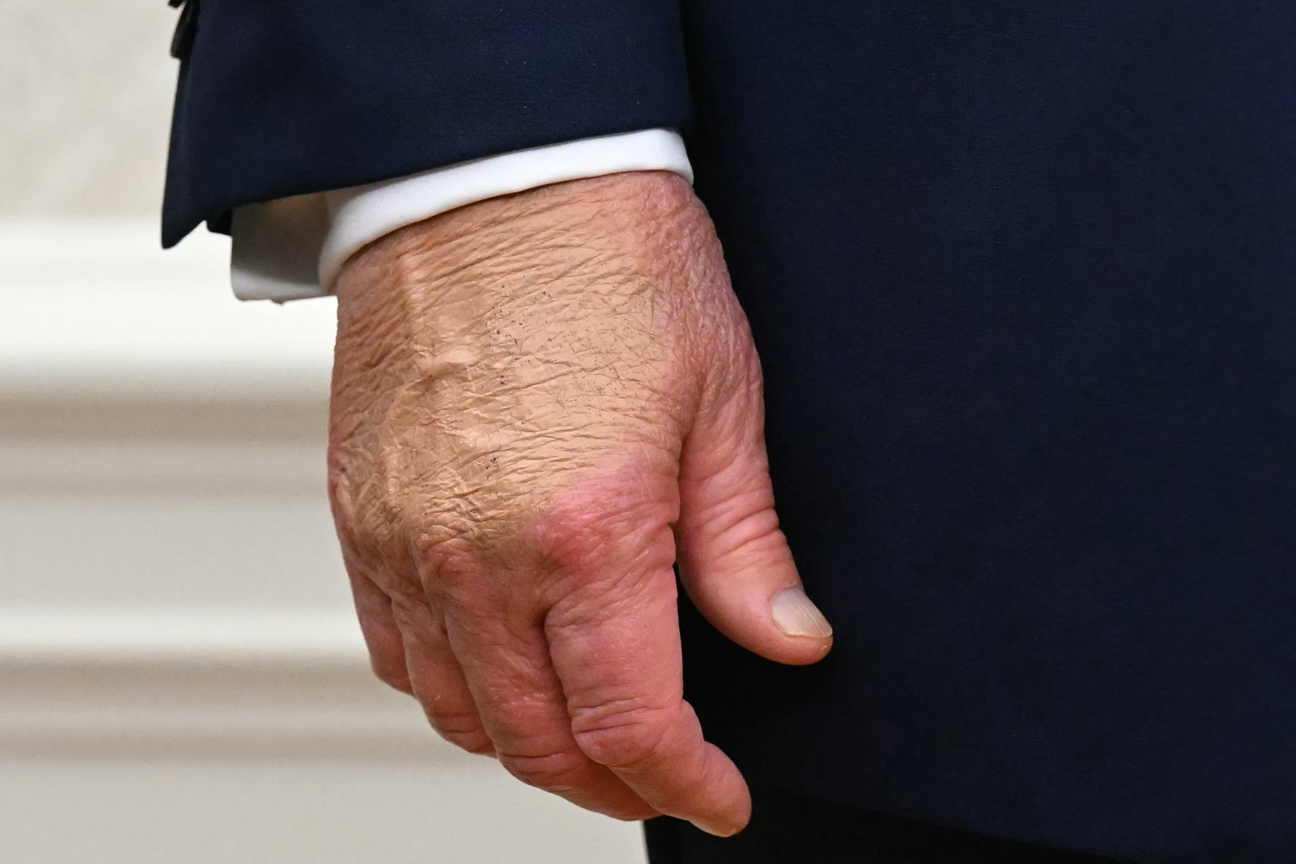 Multiple photos have shown Trump’s hands with heavy makeup on them.