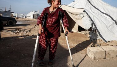 ‘My leg went to heaven before me’: Israeli war extinguishes Gaza childhoods | Israel-Palestine conflict News