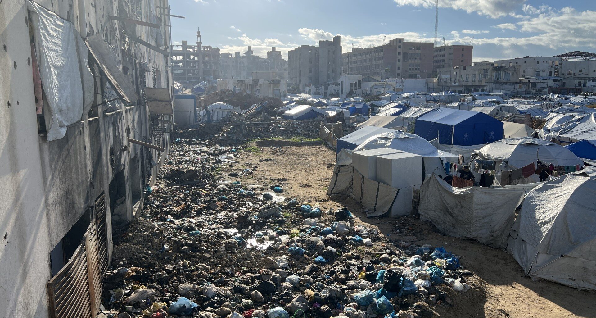 Gaza’s tent life between illness and daily despair | Israel-Palestine conflict