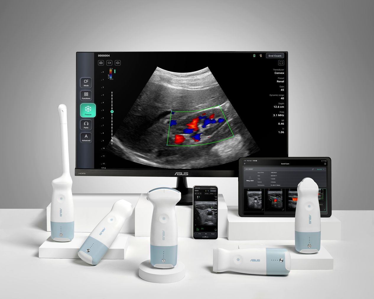 ASUS Handheld Ultrasound Solution LU800