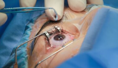 Les hospitalisations sont devenues plus courtes en Belgique, sans augmenter le taux de mortalité