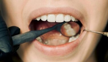 No more black fillings in Croatia under rules