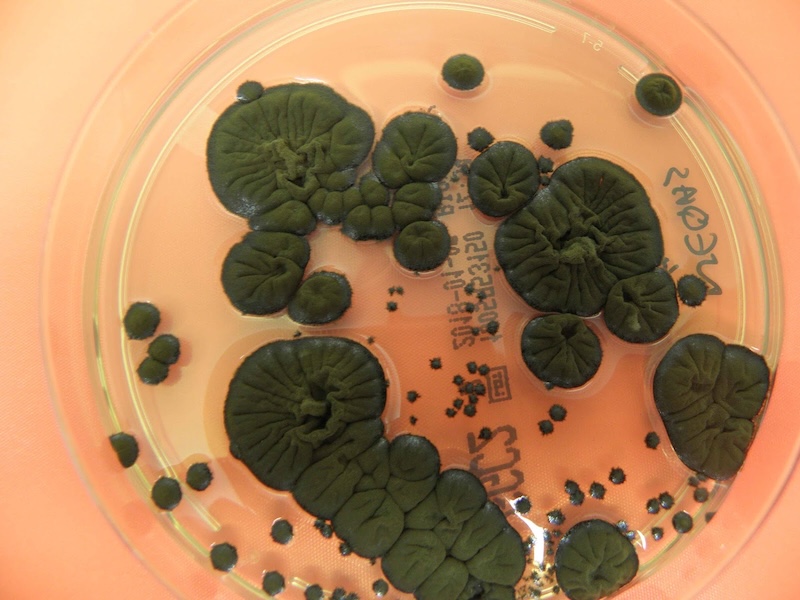 Chernobyl Black Fungus