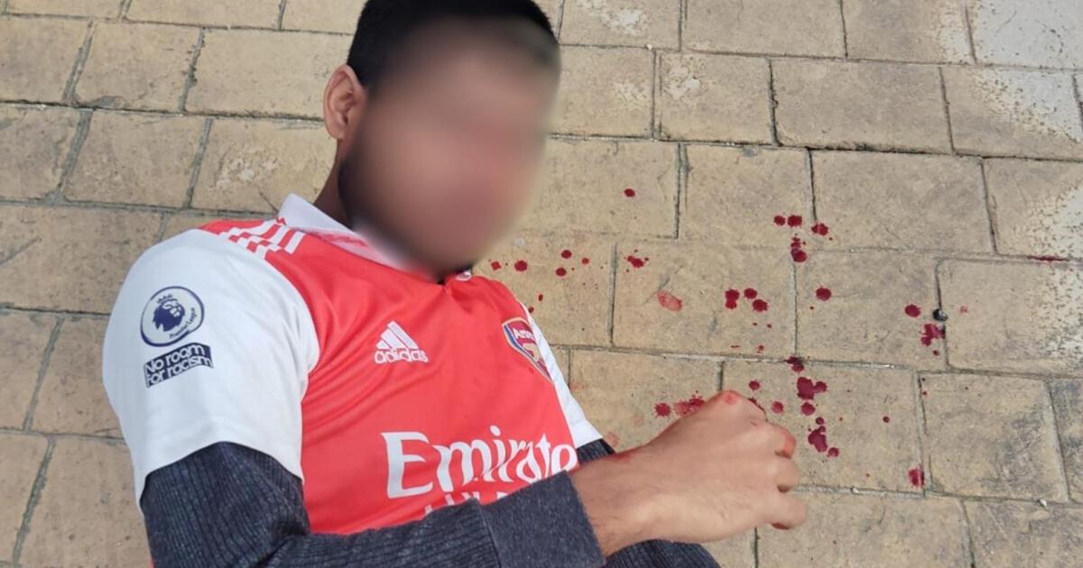 Worker ‘punched’ when asking for termination letter