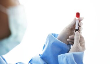 Hepatitis A: 36 Deaths Recorded in the Czech Republic Last Year