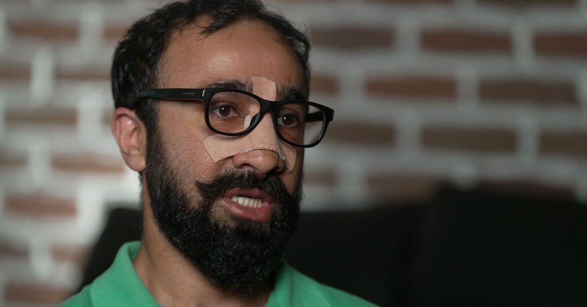 Melbourne man living in fear after brutal attack by gang of masked men