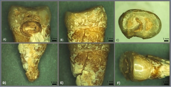 Optical Microscope Images Of The Archaeological Upper Premolar Tooth.