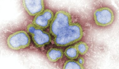 Influenza in the Czech Republic: 49 deaths this season
