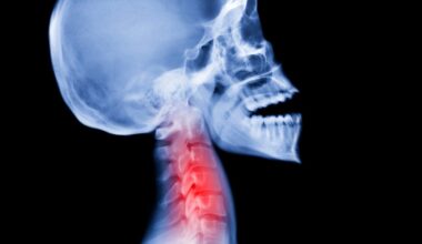 How Neanderthal Genes Influence Today's Sensitivity