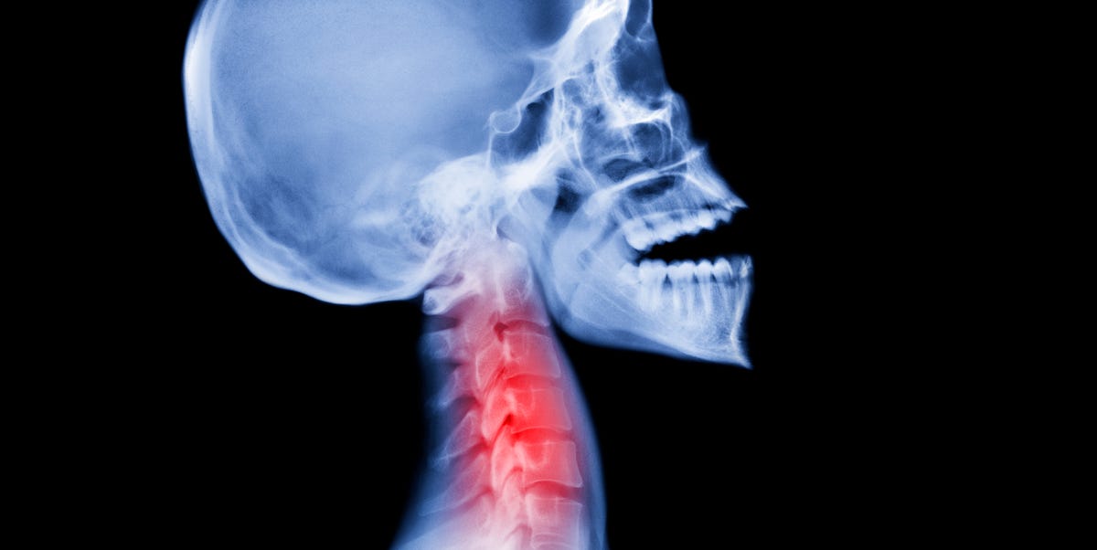 How Neanderthal Genes Influence Today's Sensitivity