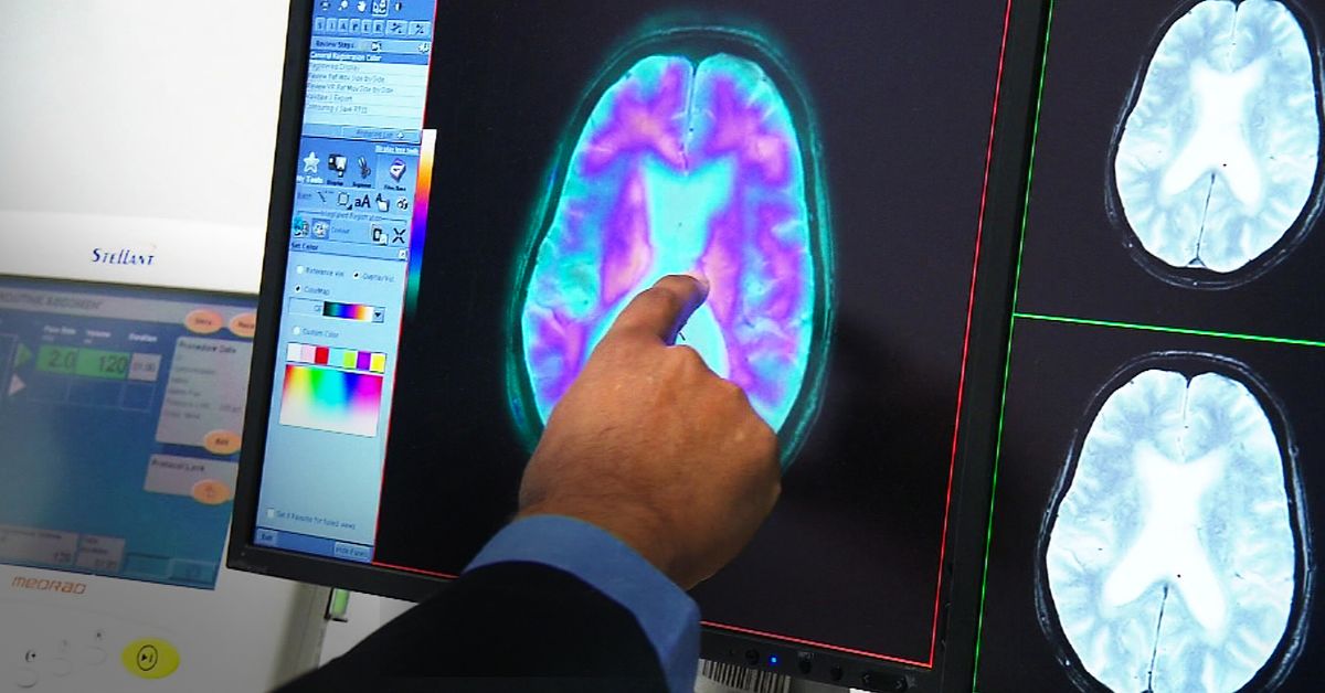 New data suggests number of Australians living with dementia set to rise