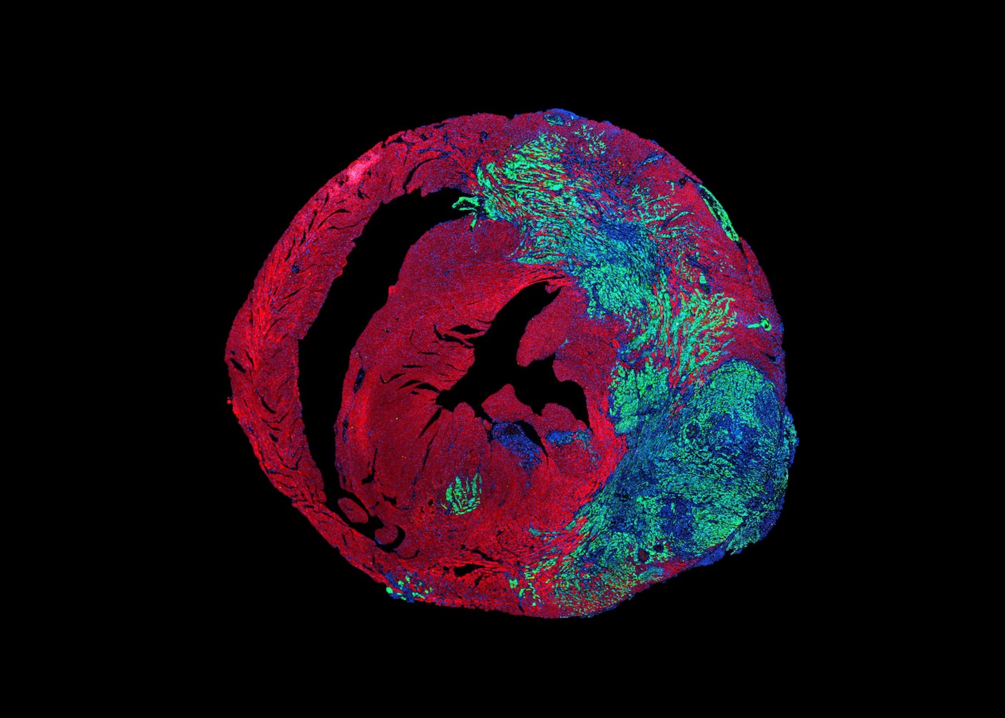 The Heart Rarely Gets Cancer. Scientists Think They Know Why.