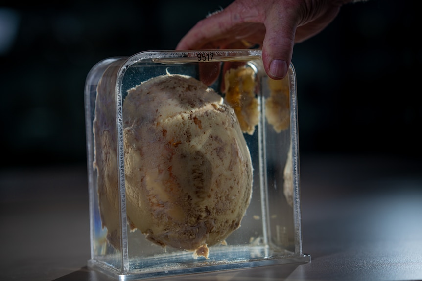 A man holding a resin block, encased inside is a damaged skull with small holes.