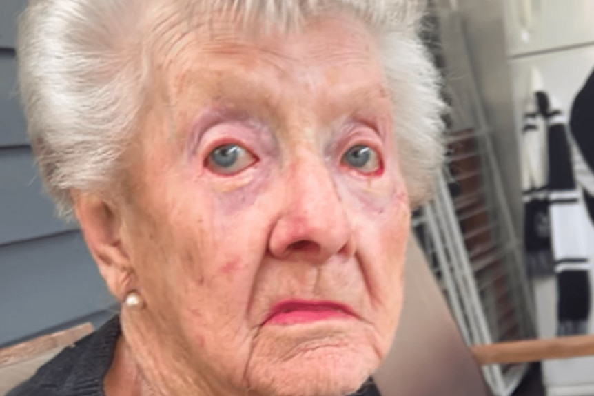 An elderly woman's face.