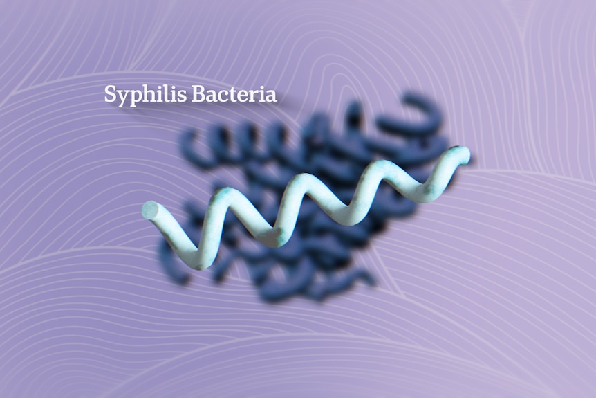 A graphic of a corkscrew shape shows what the bacteria Treponema pallidum looks like.