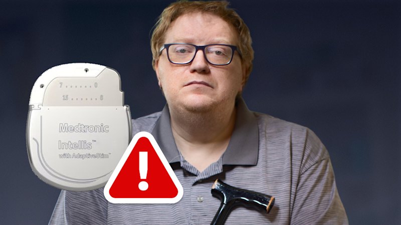 ‘Impossible to give informed consent’: Medtech giant Medtronic hid bad data from patients, doctors, show TGA freedom of information documents